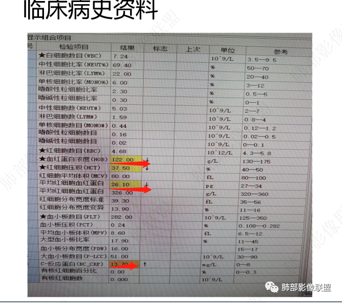 【病例】肺部这样的片状影,你是否能一锤定音?-13 【病例】肺部这样的片状影,你是否能一锤定音?-13
