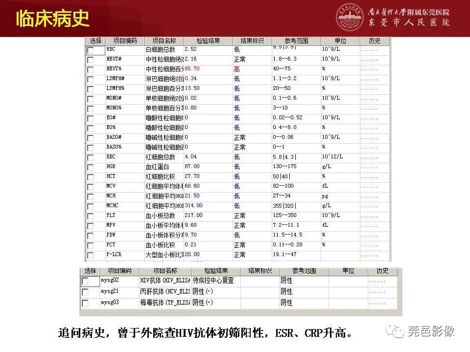 【病例】马尔尼菲蓝状菌感染1例影像学表现-14