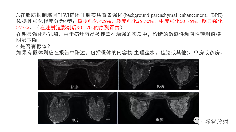 【病例】纤维囊性乳腺病伴纤维腺瘤形成 VS 乳腺增生病并间质硬化-13