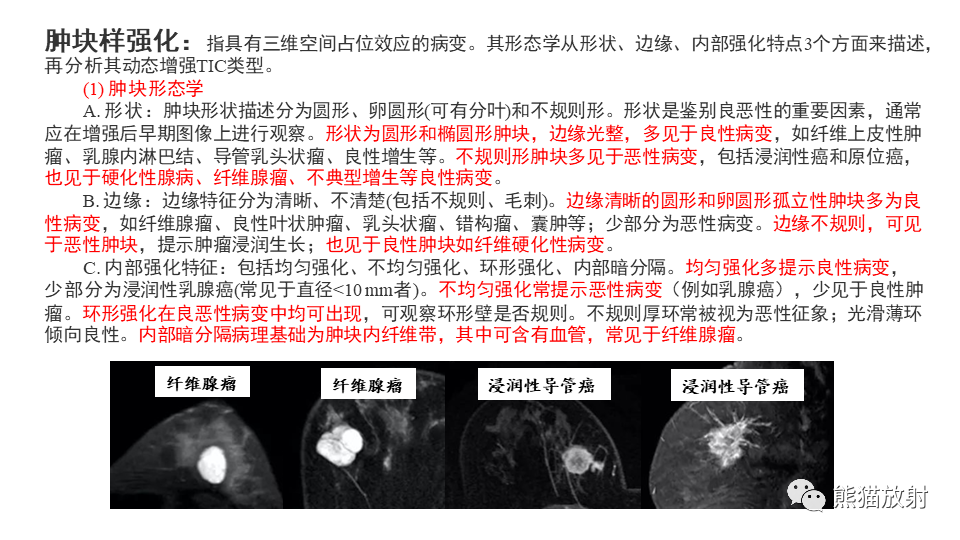 【病例】纤维囊性乳腺病伴纤维腺瘤形成 VS 乳腺增生病并间质硬化-16