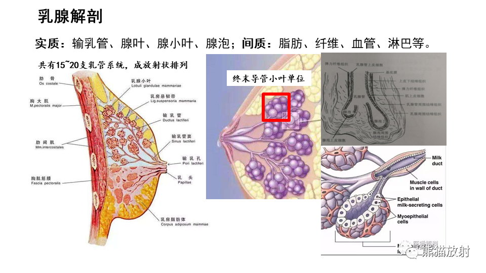 【病例】纤维囊性乳腺病伴纤维腺瘤形成 VS 乳腺增生病并间质硬化-21