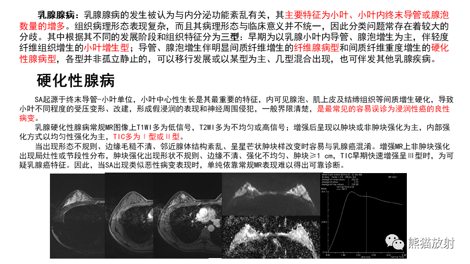 【病例】纤维囊性乳腺病伴纤维腺瘤形成 VS 乳腺增生病并间质硬化-23