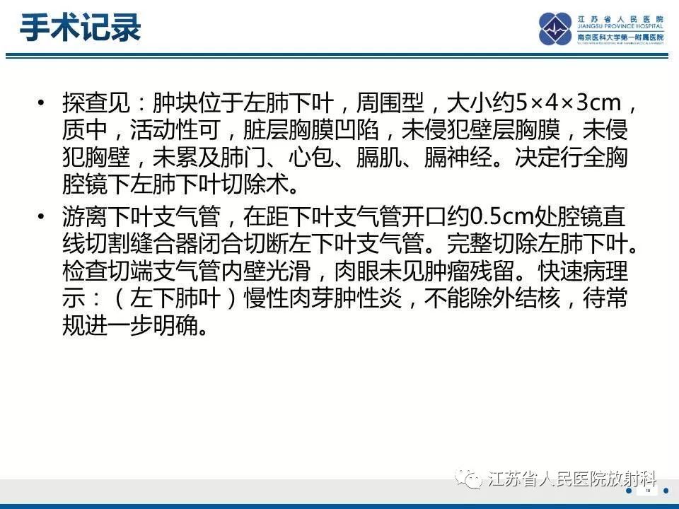 【PPT】脂质性肺炎-18