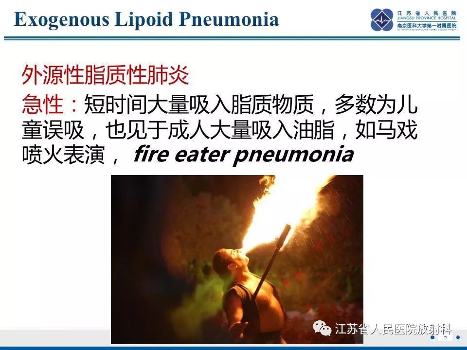 【PPT】脂质性肺炎-22