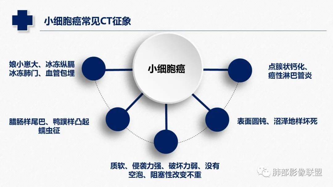 【病例】小细胞肺癌？套细胞淋巴瘤？-24