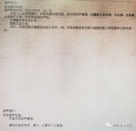 【病例】血源性金黄色葡萄球菌性肺炎1例CT影像-23