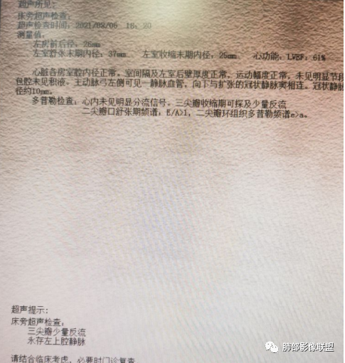 【病例】血源性金黄色葡萄球菌性肺炎1例CT影像-26