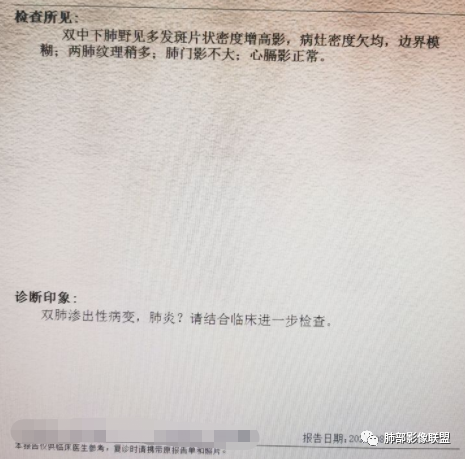 【病例】血源性金黄色葡萄球菌性肺炎1例CT影像-27