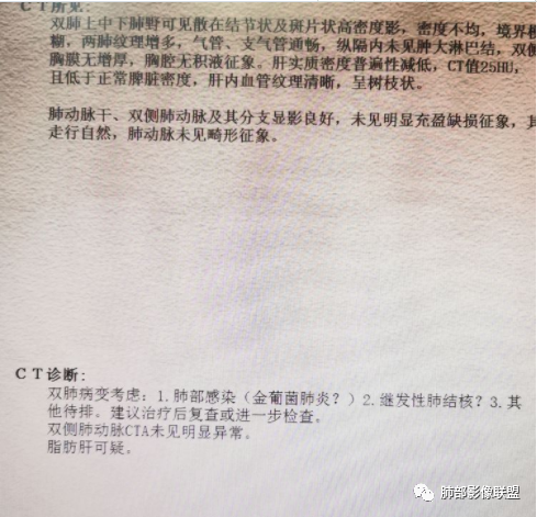 【病例】血源性金黄色葡萄球菌性肺炎1例CT影像-28