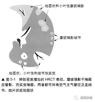 HRCT:磨玻璃影的意义 HRCT:磨玻璃影的意义
