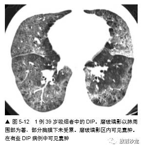 HRCT:磨玻璃影的意义 HRCT:磨玻璃影的意义