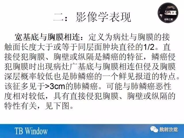 【PPT】周围型肺鳞癌的影像征象及鉴别诊断