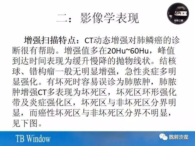 【PPT】周围型肺鳞癌的影像征象及鉴别诊断
