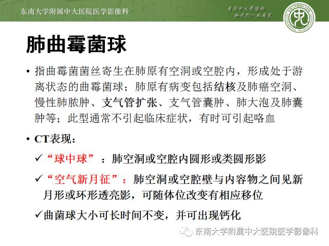 【病例】左下肺支气管囊肿伴肺曲霉菌感染