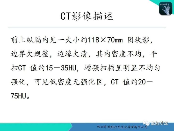 【病例】纵隔卵黄囊瘤1例CT影像表现
