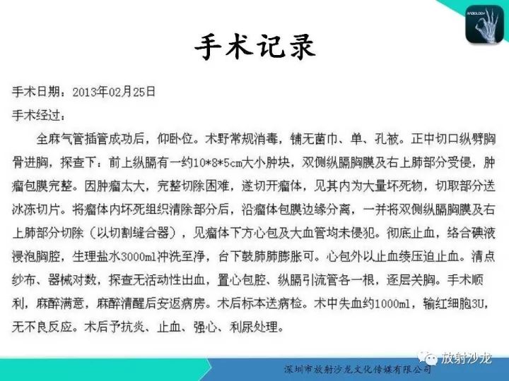 【病例】纵隔卵黄囊瘤1例CT影像表现