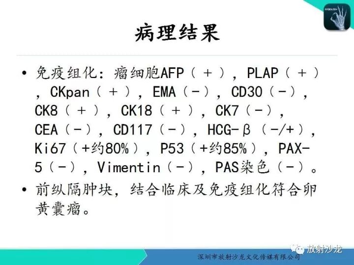 【病例】纵隔卵黄囊瘤1例CT影像表现