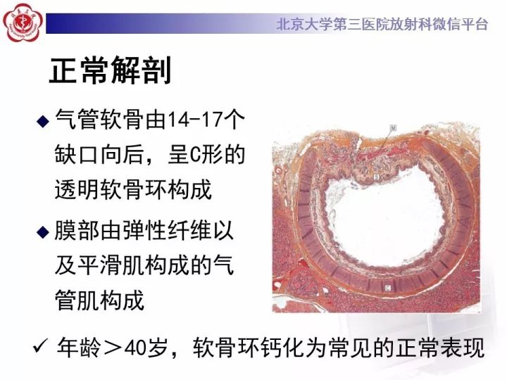 【PPT】气管的正常CT表现及疾病