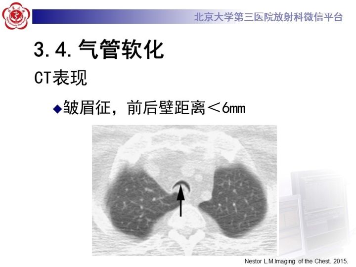 【PPT】气管的正常CT表现及疾病