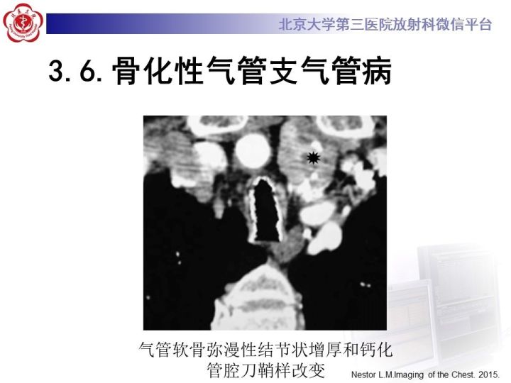 【PPT】气管的正常CT表现及疾病