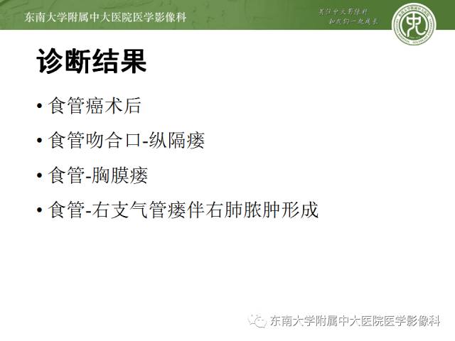 【病例】食道纵隔胸膜瘘1例CT