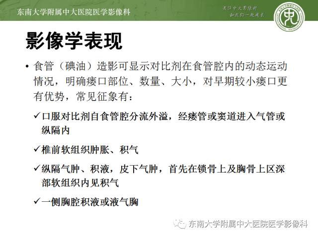 【病例】食道纵隔胸膜瘘1例CT