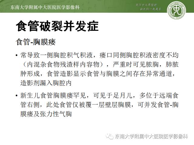 【病例】食道纵隔胸膜瘘1例CT