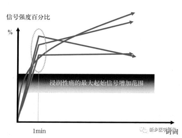 诊断乳腺的病变的主要可靠征象