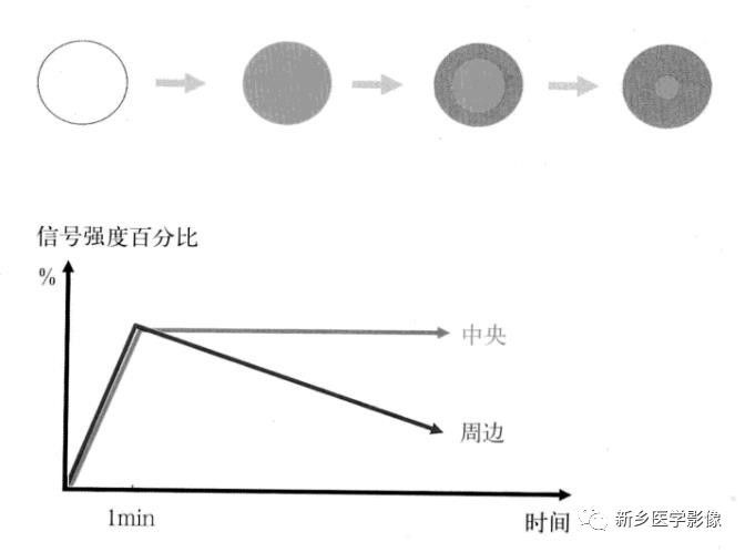 诊断乳腺的病变的主要可靠征象