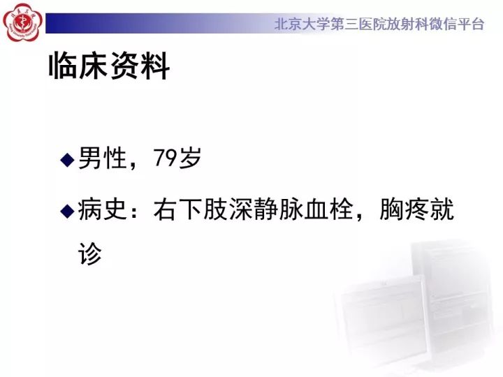 【病例】双主动脉弓畸形1例CT