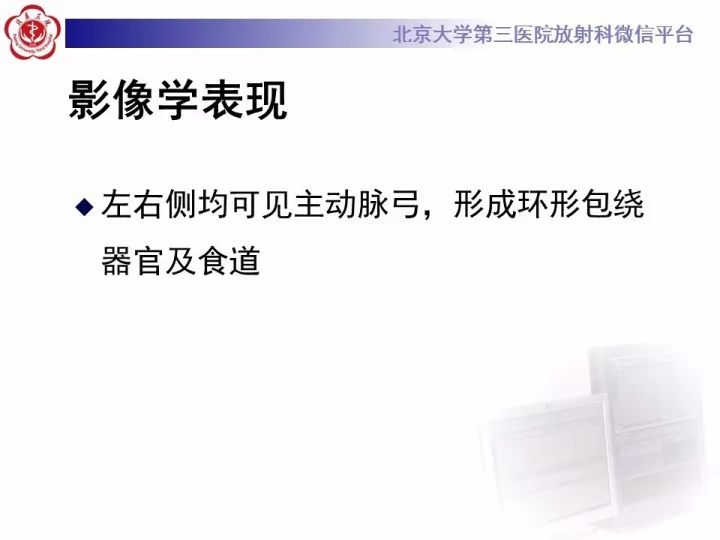 【病例】双主动脉弓畸形1例CT