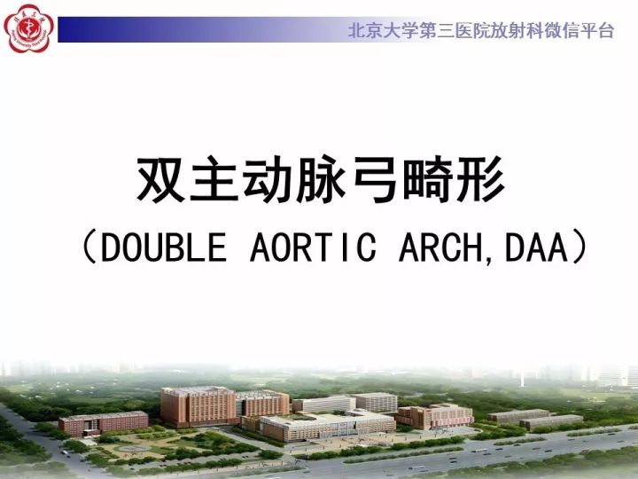 【病例】双主动脉弓畸形1例CT