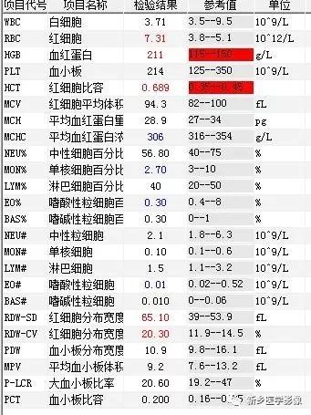 【病例】肺动脉静脉畸形1例CT