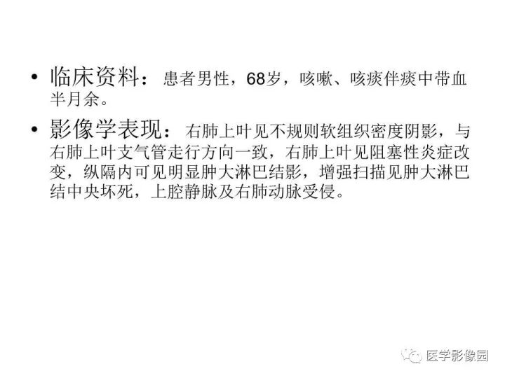【病例】右肺上叶小细胞性肺癌1例CT影像表现