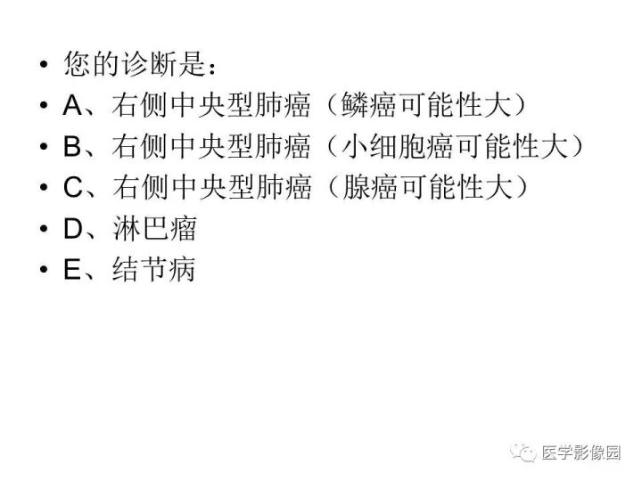 【病例】右肺上叶小细胞性肺癌1例CT影像表现