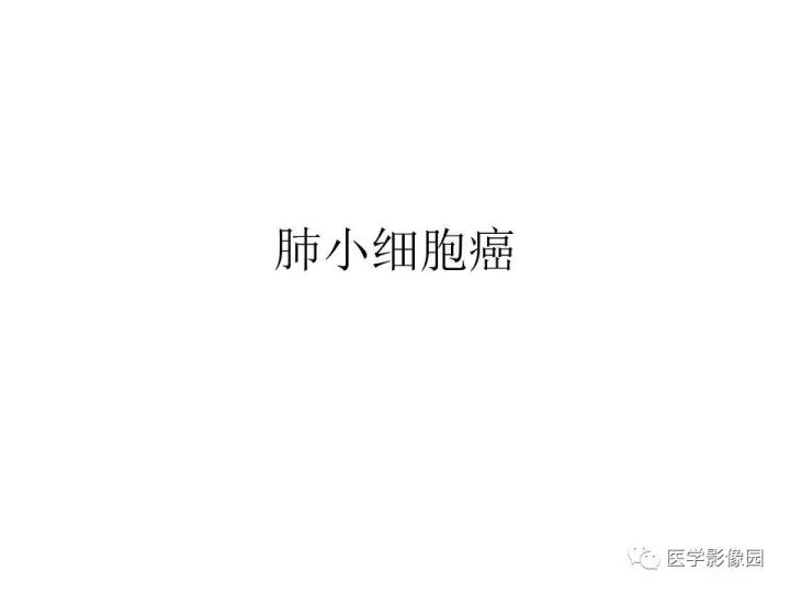 【病例】右肺上叶小细胞性肺癌1例CT影像表现