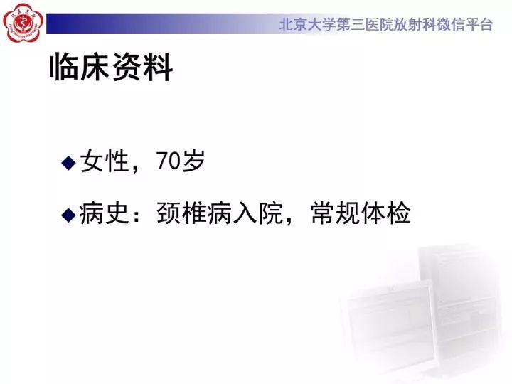 【病例】右位主动脉弓合并迷走左锁骨下动脉1例CT