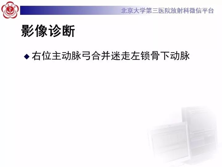 【病例】右位主动脉弓合并迷走左锁骨下动脉1例CT