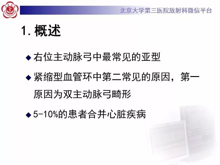 【病例】右位主动脉弓合并迷走左锁骨下动脉1例CT