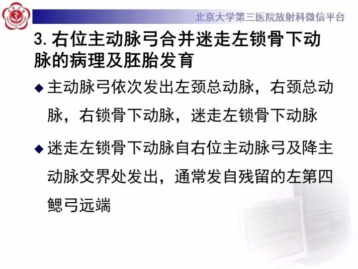 【病例】右位主动脉弓合并迷走左锁骨下动脉1例CT