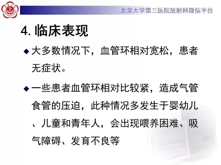 【病例】右位主动脉弓合并迷走左锁骨下动脉1例CT