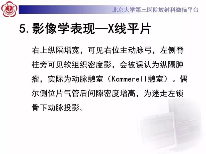 【病例】右位主动脉弓合并迷走左锁骨下动脉1例CT