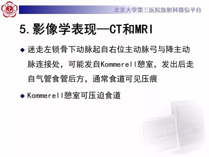【病例】右位主动脉弓合并迷走左锁骨下动脉1例CT
