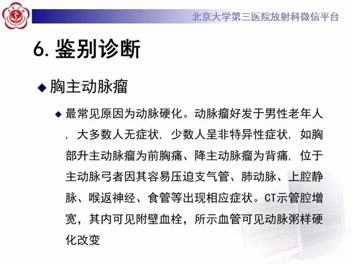 【病例】右位主动脉弓合并迷走左锁骨下动脉1例CT