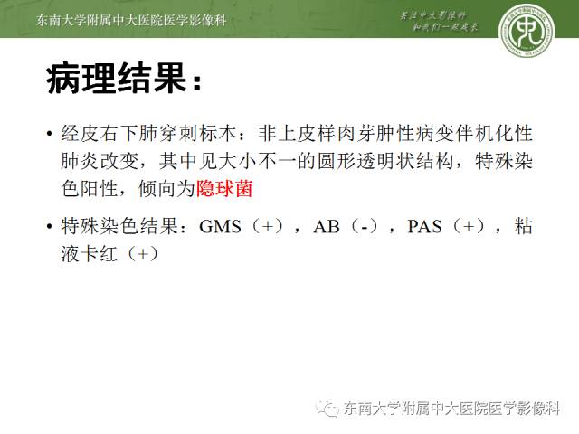【病例】肺隐球菌病1例CT影像表现