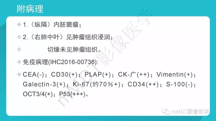 【PPT】纵隔肿瘤影像诊断（全）