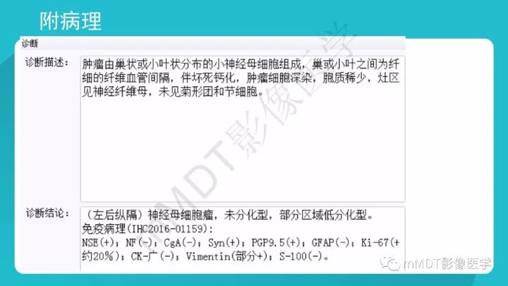 【PPT】纵隔肿瘤影像诊断（全）