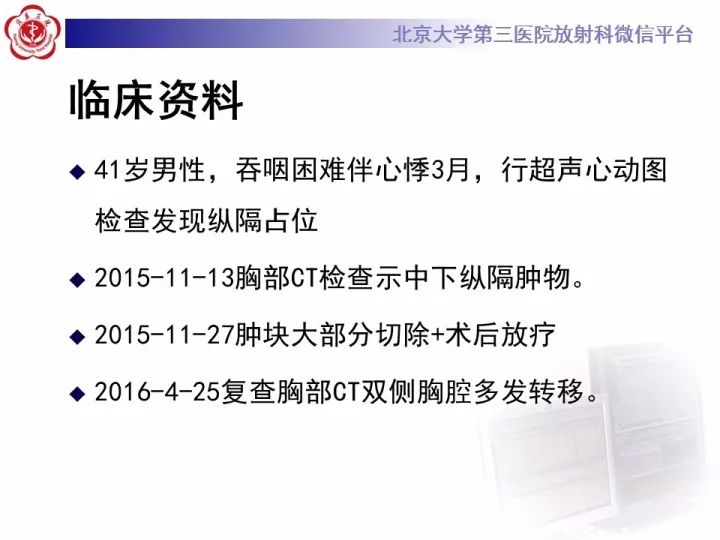 【病例】纵隔滑膜肉瘤1例CT影像表现