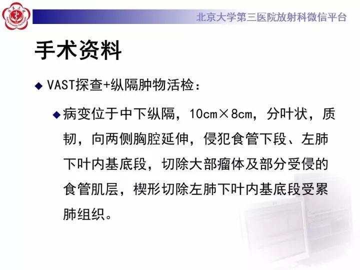 【病例】纵隔滑膜肉瘤1例CT影像表现