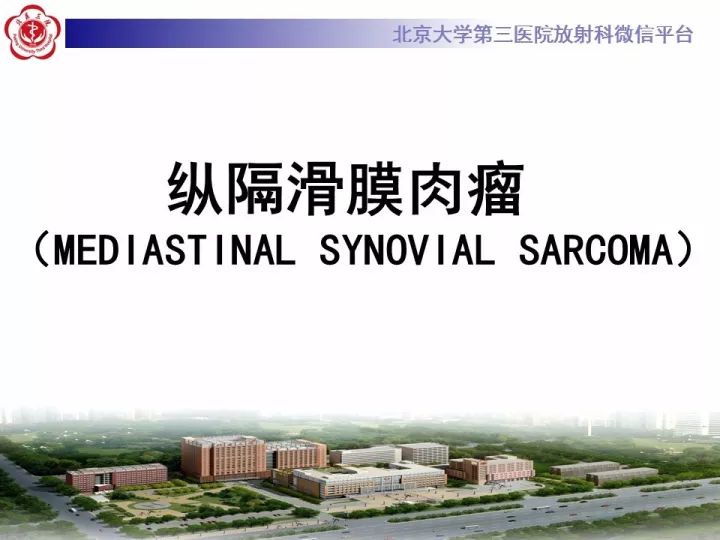 【病例】纵隔滑膜肉瘤1例CT影像表现